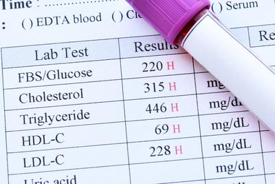 Docelowe stężenie cholesterolu LDL u chorych na cukrzycę powinno wynosić poniżej 70 mg/dl.