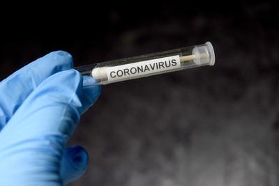Zgodnie z nową strategią walki z COVID-19, testy na obecność koronawirusa wykonuje się u osób objawowych, a nie jak w pierwszych miesiącach epidemii również u osób podejrzanych o zakażenie np. z kwarantanny.