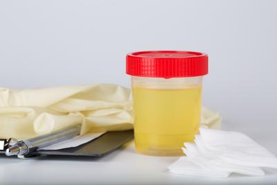 Albuminuria, czyli obecność albumin w moczu, jest objawem chorób nerek. Z badań wynika, że może też być markerem chorób płuc.