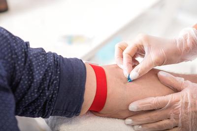 Test IsoPSA pozwala uniknąć biopsji w 45,1 proc. przypadków podejrzenia raka prostaty