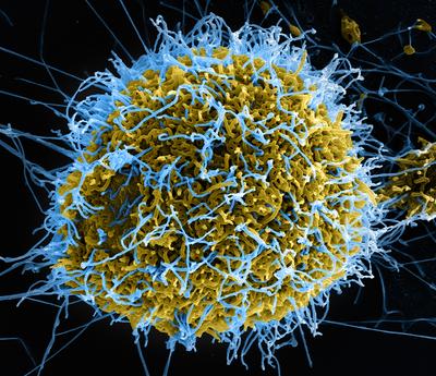 Cząsteczka wirusa Ebola