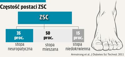 Infografika: Częstość postaci zespołu stopy cukrzycowej