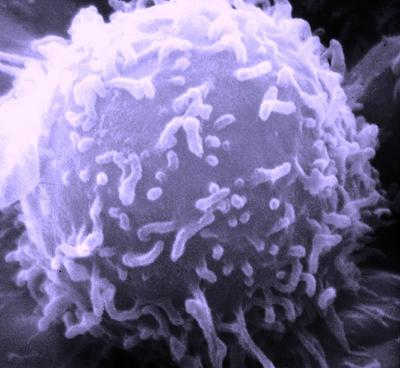 Komórka limfocytu, Fot. Dr. Triche National Cancer Institute, Wikipedia Commons