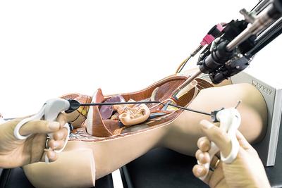 Przykład zastosowania robota Robin Heart PortVisionAble podczas wideooperacji (operator pracuje dwoma narzędziami endoskopowymi, a tor wizyjny jest utrzymywany przez sterowane ramię robota).