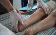 Ustawa o zawodzie fizjoterapeuty krytykowana przez lekarzy