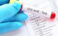 Kiedy diagnozować i jak leczyć hiperurykemię? Eksperci ogłosili konsensus