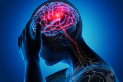 Objawy neurologiczne były znacznie częstsze u pacjentów z ciężkim przebiegiem COVID-19 - wynika z analizy danych medycznych 214 pacjentów leczonych na COVID-19 w Wuhanie (Chiny).