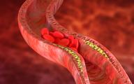 Co jeszcze można zrobić dla pacjentów z hipercholesterolemią rodzinną