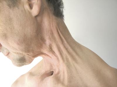U pacjentów onkologicznych techniki rozluźniania mięśniowo-powięziowego należy stosować w miejscach, gdzie obserwuje się ograniczenia ruchomości tkanek. Terapia powinna rozpocząć się wkrótce po zagojeniu się rany.