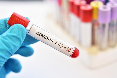 W Polsce potwierdzono przypadki zakażenia koronawirusem SARS-CoV-2 (COVID-19).
