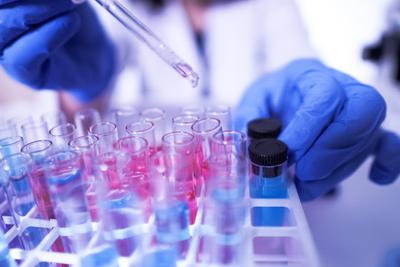 Nowy szybki test na koronawirusa SARS-CoV-2 można wprowadzić tam, gdzie dostęp do standardowych testów laboratoryjnych jest ograniczony