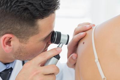 Wczesna diagnoza czerniaka odbywa najczęściej się za pomocą kryteriów ABCDE, umożliwiających identyfikację części czerniaków.