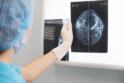 Informacje o placówkach wykonujących bezpłatną mammografię są dostępne na stronach oddziałów wojewódzkich NFZ.