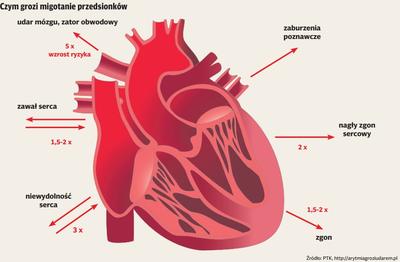 Źródło: PTK, http://arytmiagroziudarem.pl