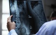 Kalkulator ryzyka złamań osteoporotycznych