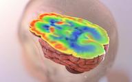 Nieprawidłowy metabolizm glukozy może nasilać objawy choroby Alzheimera