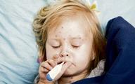 Odra rozprzestrzenia się szybko, więc łatwo dochodzi do epidemii